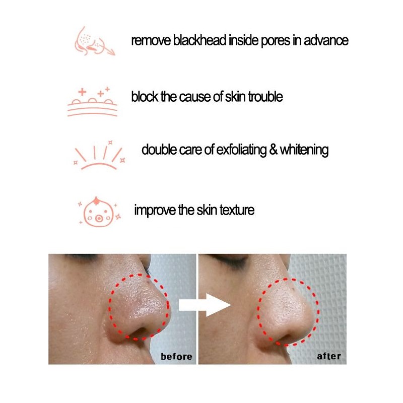 Coslx BHA Cairan Daya Komedo 1 - Skincare Cosrx ulasan dan harga