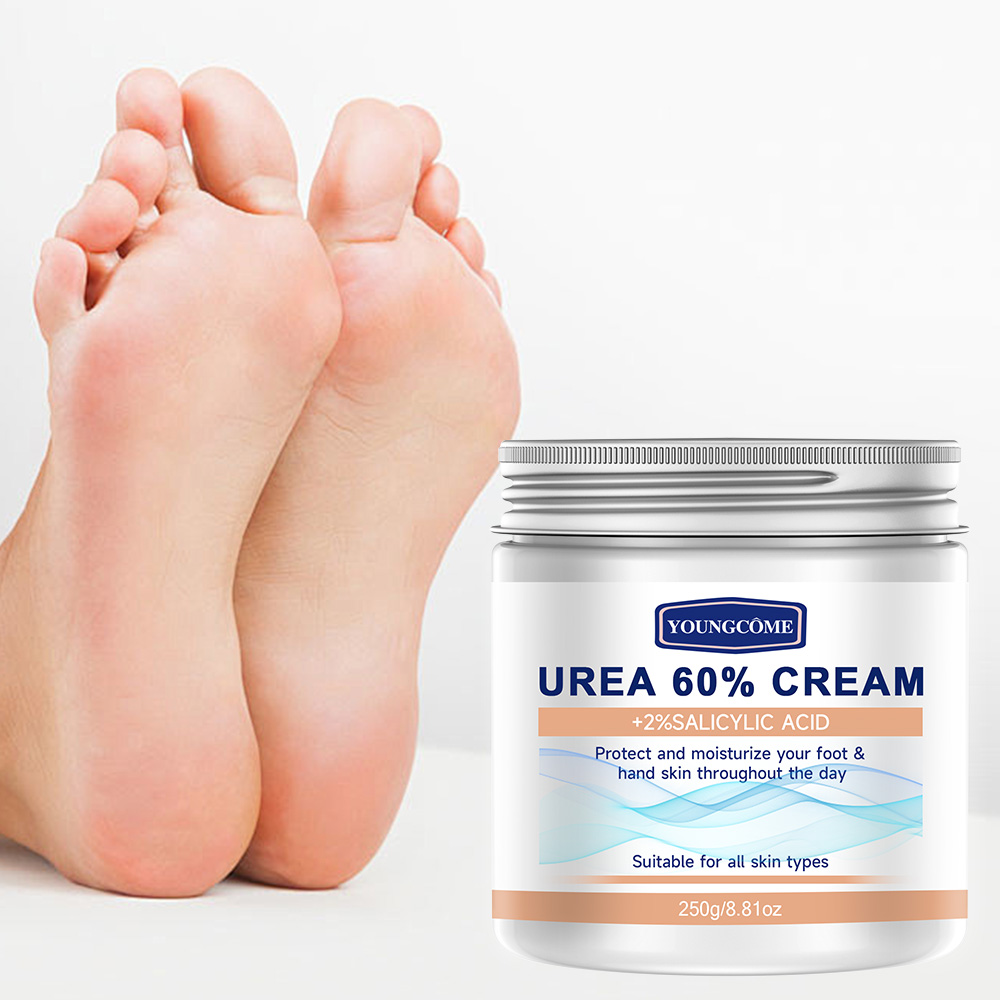 YOUNGCOME 250G Krim Urea denga - Azelaic Acid Cream ulasan dan harga