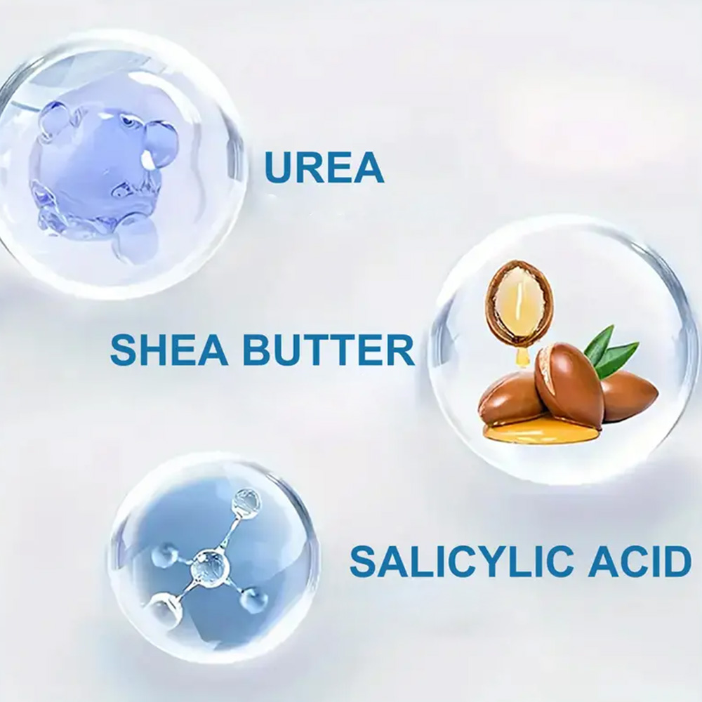 YOUNGCOME 250G Krim Urea denga - Azelaic Acid Cream ulasan dan harga