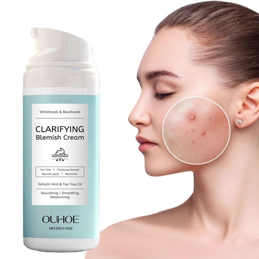 Krim Wajah Asam Salisilat untu - Azelaic Acid Cream ulasan dan harga
