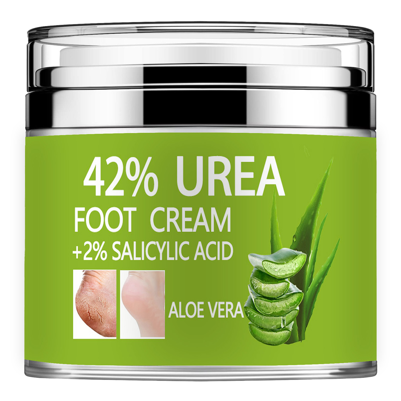 Krim Urea 42% Plus asam salisi - Azelaic Acid Cream ulasan dan harga